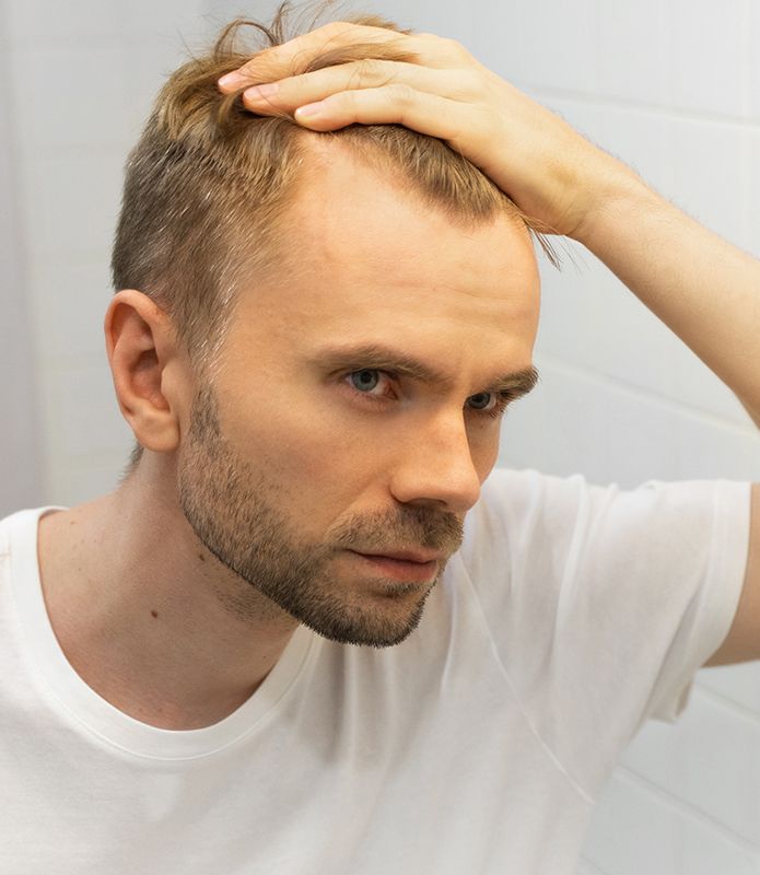 Causas da Queda de Cabelo nos Homens