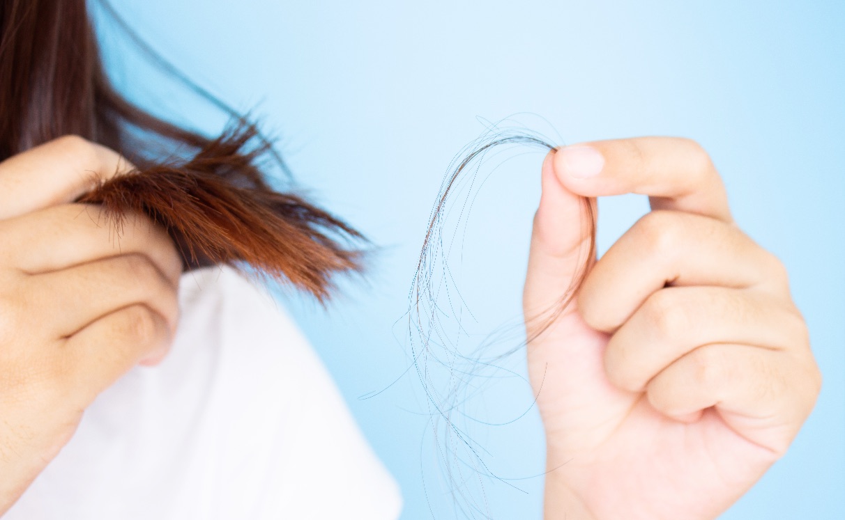 Queda de Cabelo Feminino