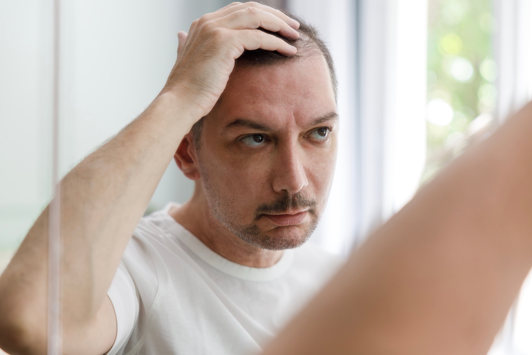 Impacto emocional da perda de cabelo nos homens