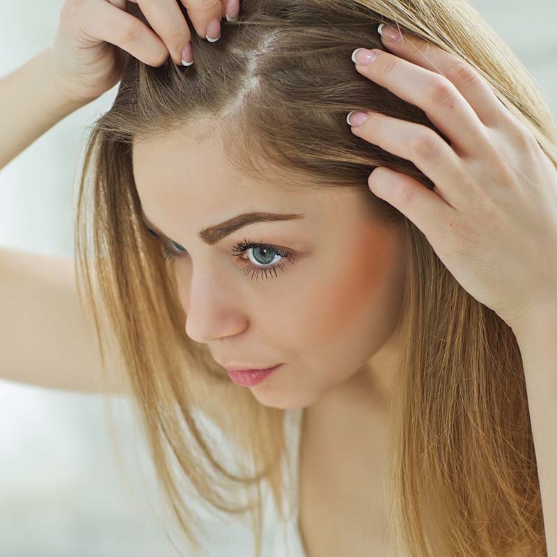 Female Baldness  